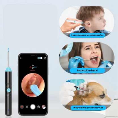EchoClean™ Dispositivo inteligente que cuida tus oídos con máxima precisión.